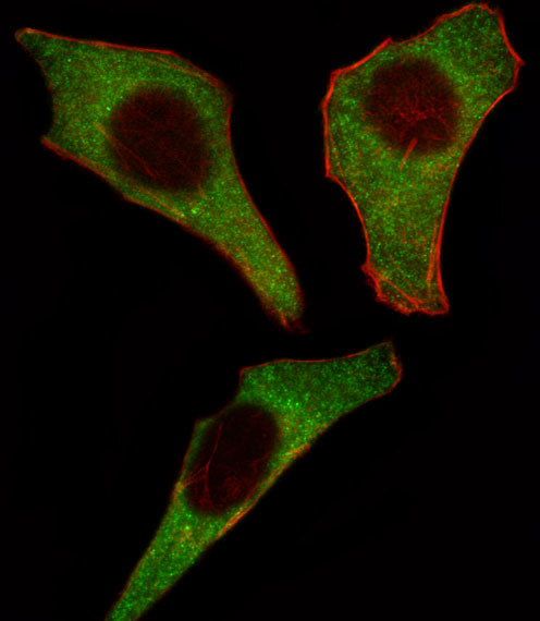 CDK4 Antibody in Immunocytochemistry (ICC/IF)