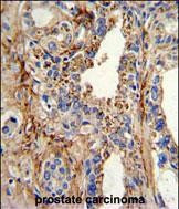 CDK4 Antibody in Immunohistochemistry (Paraffin) (IHC (P))