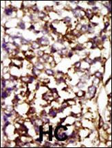 CDK4 Antibody in Immunohistochemistry (Paraffin) (IHC (P))