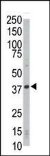 CDK4 Antibody in Western Blot (WB)