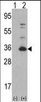 CDK4 Antibody in Western Blot (WB)