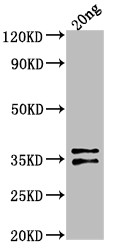 ARCA Antibody in Western Blot (WB)