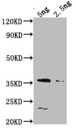 DCM Antibody in Western Blot (WB)