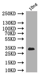 Clathrin Heavy Chain Antibody in Western Blot (WB)