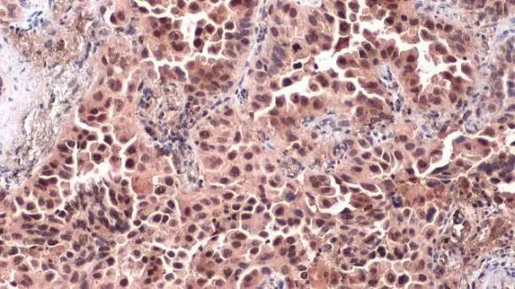 c-Jun Antibody in Immunohistochemistry (Paraffin) (IHC (P))