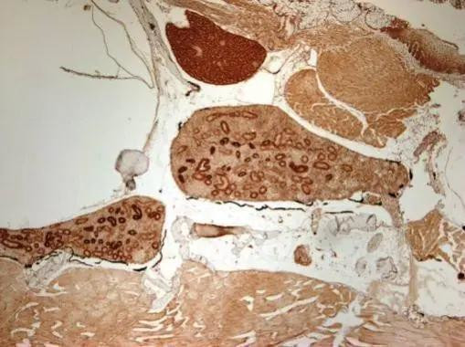 SOD2 Antibody in Immunohistochemistry (Paraffin) (IHC (P))