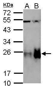 TAGLN Antibody in Western Blot (WB)