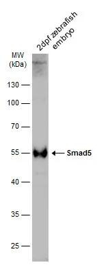 SMAD5 Antibody in Western Blot (WB)