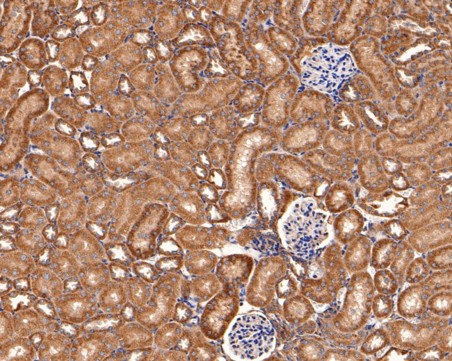 IL-22 Receptor alpha Antibody in Immunohistochemistry (Paraffin) (IHC (P))