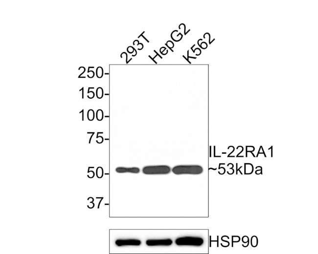 IL-22 Receptor alpha Antibody in Western Blot (WB)