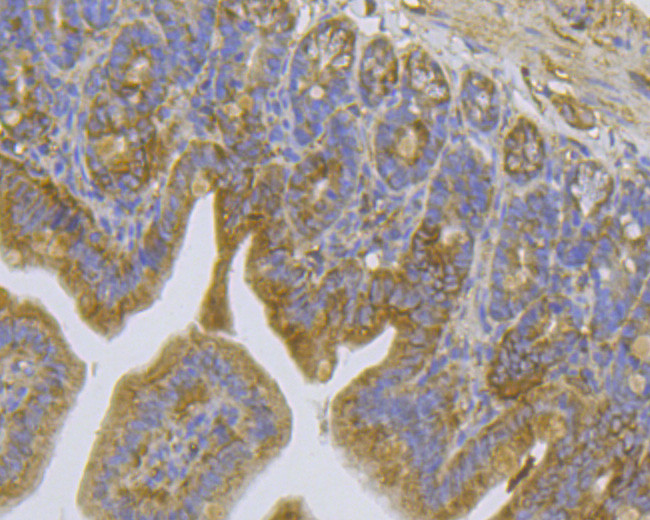 TRPV6 Antibody in Immunohistochemistry (Paraffin) (IHC (P))