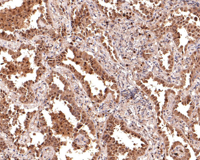 PSMB7 Antibody in Immunohistochemistry (Paraffin) (IHC (P))