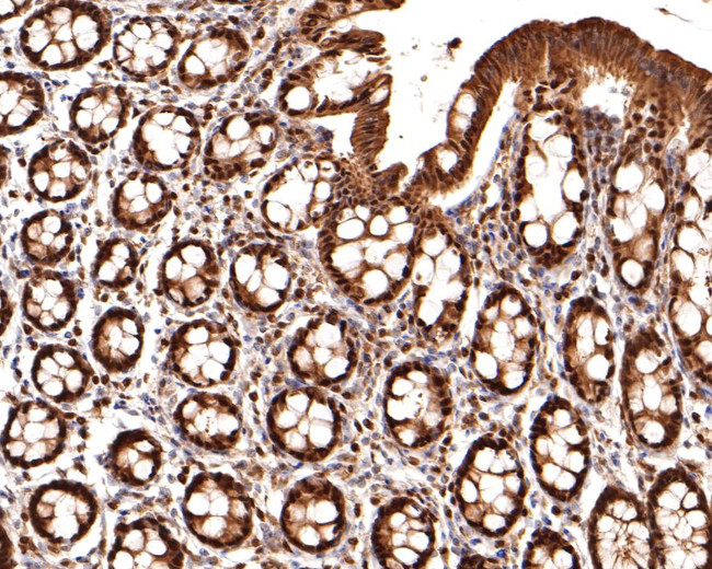 PSMB7 Antibody in Immunohistochemistry (Paraffin) (IHC (P))