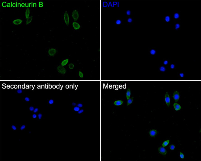 Calcineurin B Antibody in Immunocytochemistry (ICC/IF)