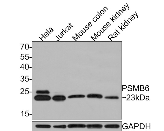 PSMB6 Antibody in Western Blot (WB)