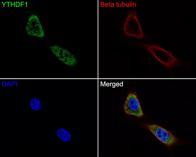 YTHDF1 Antibody in Immunocytochemistry (ICC/IF)