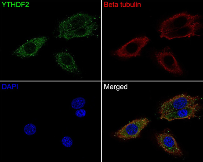 YTHDF2 Antibody in Immunocytochemistry (ICC/IF)