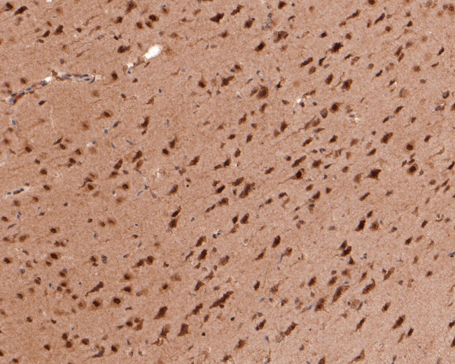 PSMC5 Antibody in Immunohistochemistry (Paraffin) (IHC (P))