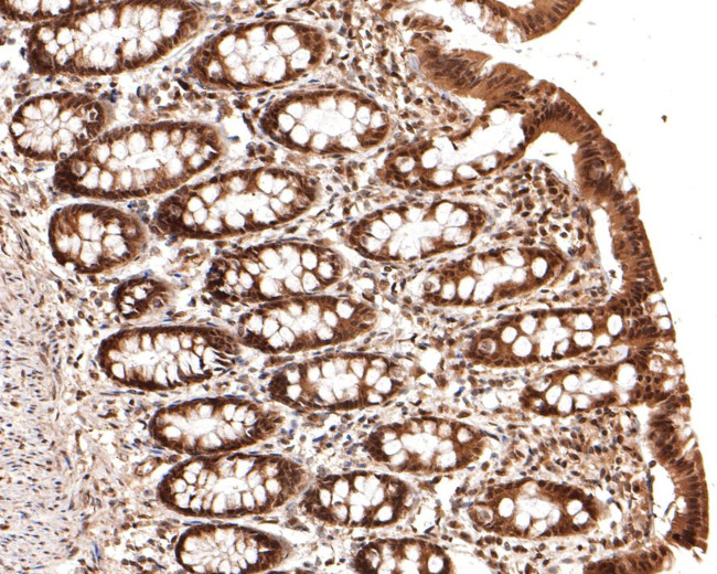 PSMC5 Antibody in Immunohistochemistry (Paraffin) (IHC (P))