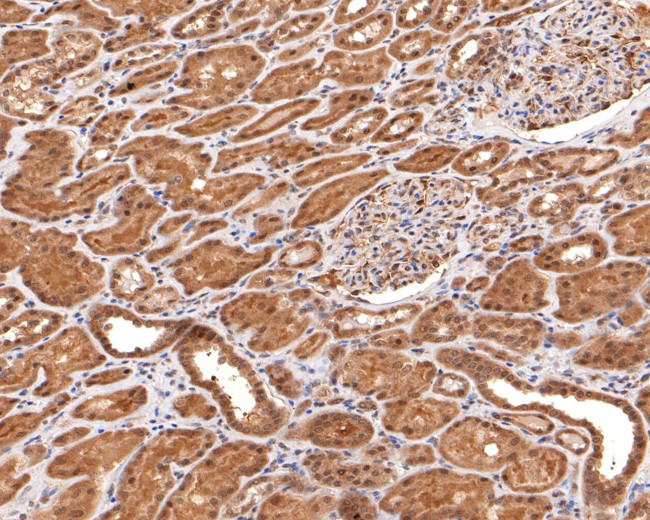 PSMC5 Antibody in Immunohistochemistry (Paraffin) (IHC (P))