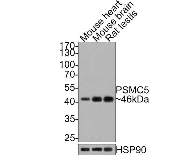 PSMC5 Antibody in Western Blot (WB)