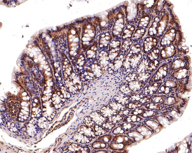 PSMD2 Antibody in Immunohistochemistry (Paraffin) (IHC (P))