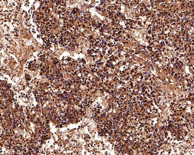 PSMD2 Antibody in Immunohistochemistry (Paraffin) (IHC (P))