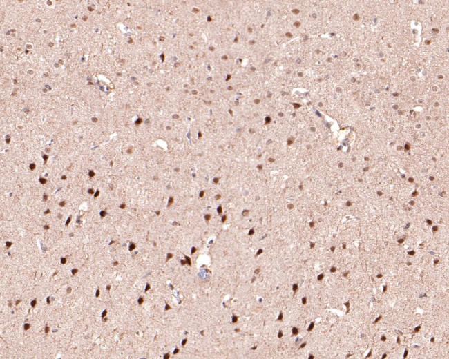 PSMD7 Antibody in Immunohistochemistry (Paraffin) (IHC (P))