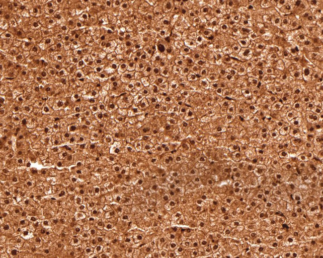 RUVBL1 Antibody in Immunohistochemistry (Paraffin) (IHC (P))