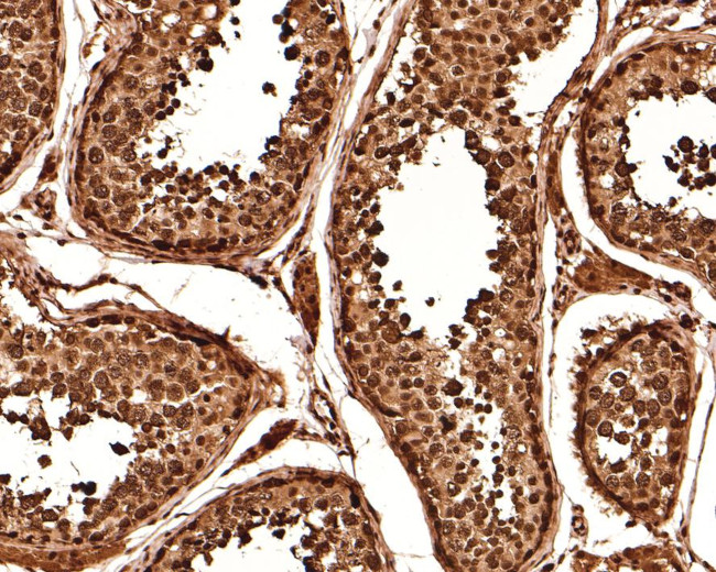 RUVBL1 Antibody in Immunohistochemistry (Paraffin) (IHC (P))