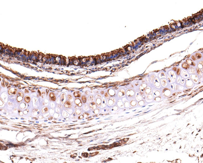 RUVBL1 Antibody in Immunohistochemistry (Paraffin) (IHC (P))