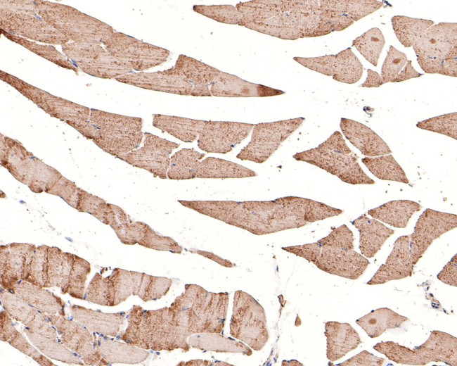 RUVBL1 Antibody in Immunohistochemistry (Paraffin) (IHC (P))