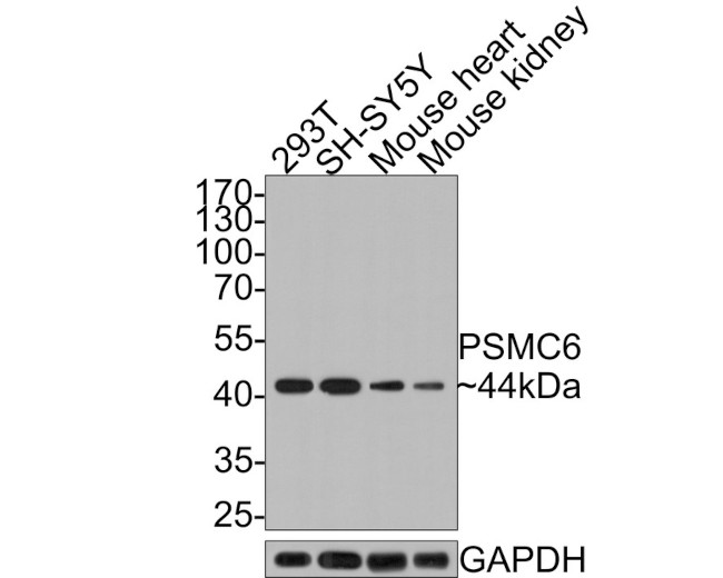 PSMC6 Antibody in Western Blot (WB)