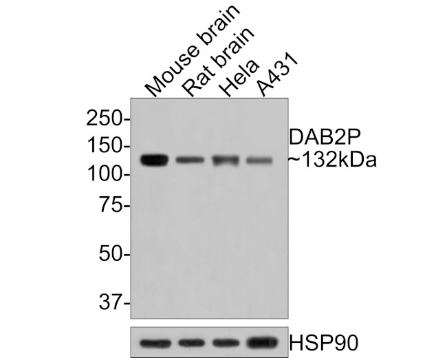 DAB2IP Antibody in Western Blot (WB)