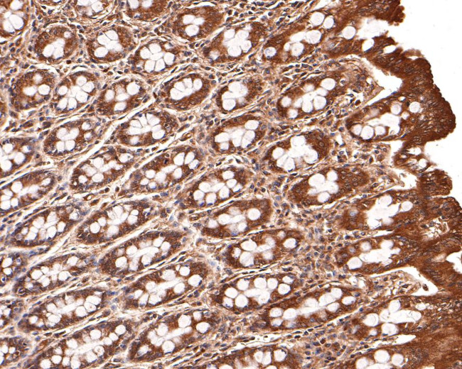 LIGHT Antibody in Immunohistochemistry (Paraffin) (IHC (P))