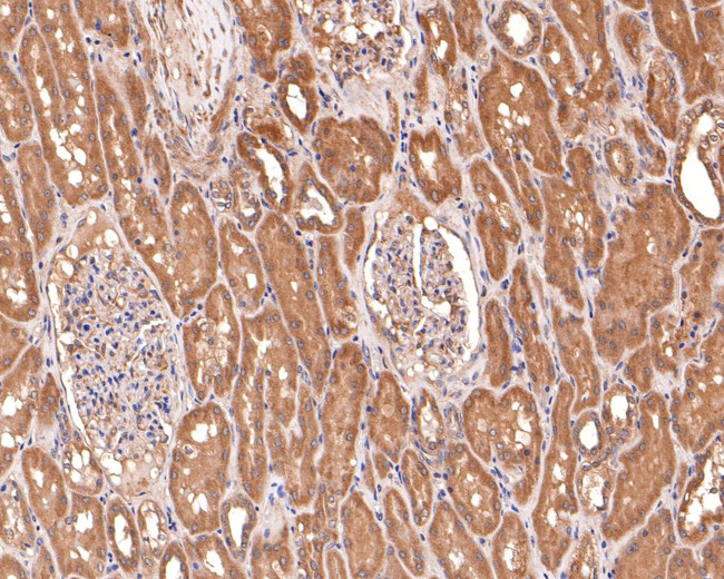 LIGHT Antibody in Immunohistochemistry (Paraffin) (IHC (P))