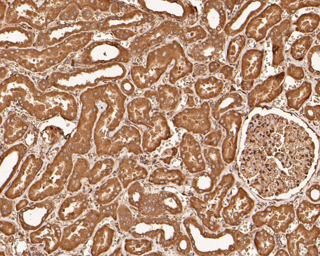 EIF2S1 Antibody in Immunohistochemistry (Paraffin) (IHC (P))