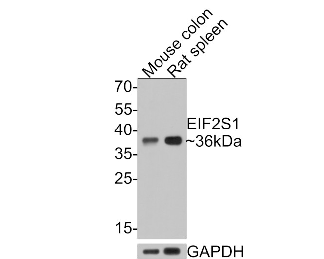 EIF2S1 Antibody in Western Blot (WB)