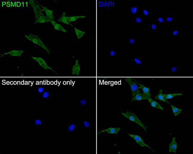 PSMD11 Antibody in Immunocytochemistry (ICC/IF)