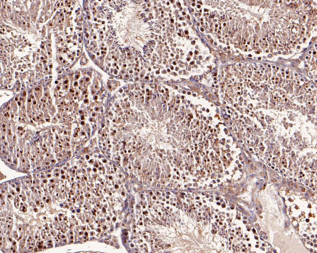 PSMD11 Antibody in Immunohistochemistry (Paraffin) (IHC (P))