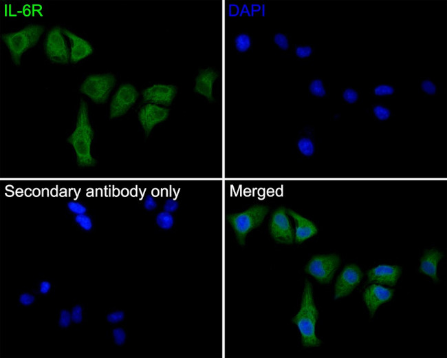 IL-6 Receptor Antibody in Immunocytochemistry (ICC/IF)