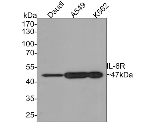 IL-6 Receptor Antibody in Western Blot (WB)