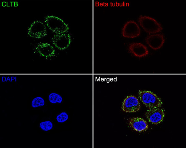 CLBT Antibody in Immunocytochemistry (ICC/IF)