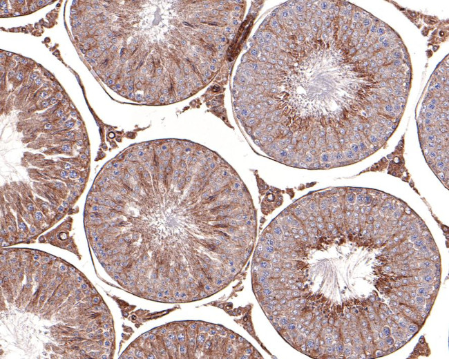 CLBT Antibody in Immunohistochemistry (Paraffin) (IHC (P))