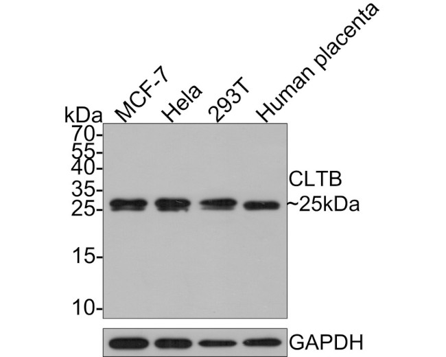 CLBT Antibody in Western Blot (WB)