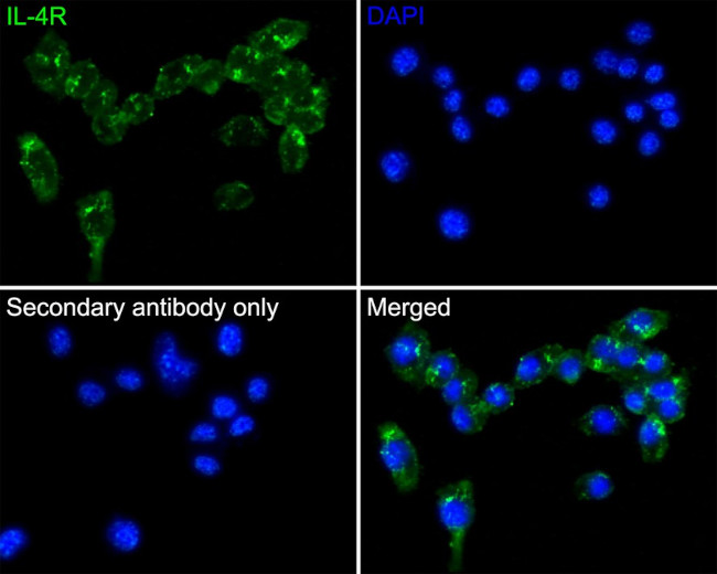 IL4R Antibody in Immunocytochemistry (ICC/IF)