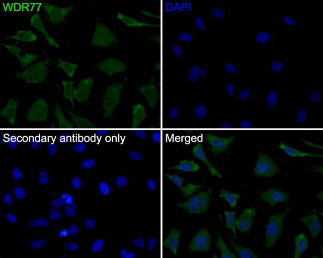 WDR77 Antibody in Immunocytochemistry (ICC/IF)