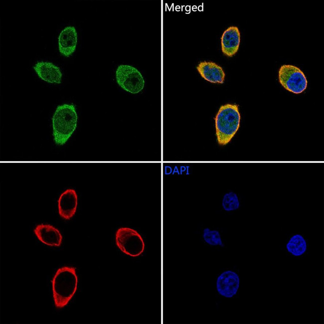 PSMB3 Antibody in Immunocytochemistry (ICC/IF)