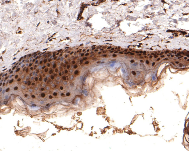 PSMB3 Antibody in Immunohistochemistry (Paraffin) (IHC (P))