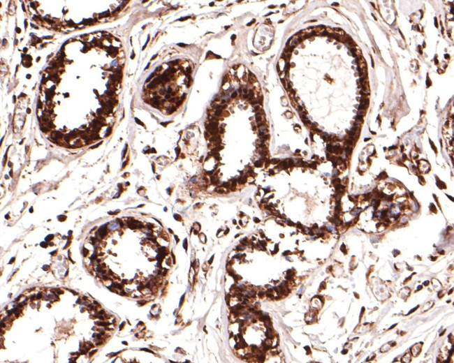 PSMB3 Antibody in Immunohistochemistry (Paraffin) (IHC (P))